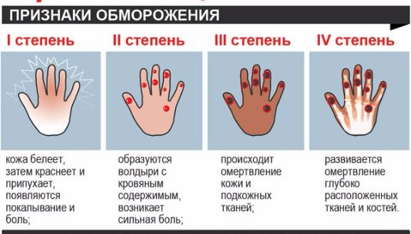 �����������: ��������, �������, �����������