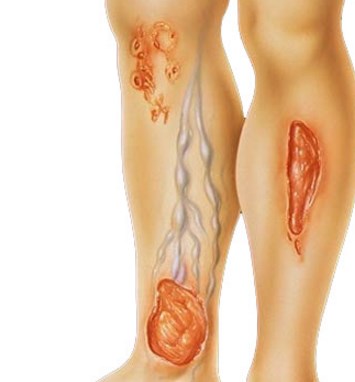 ����������� ���� � �������